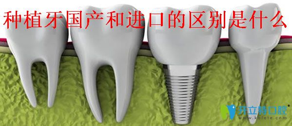 種植一顆牙價(jià)格是多少 種植牙是國(guó)產(chǎn)好還是進(jìn)口好區(qū)別在哪