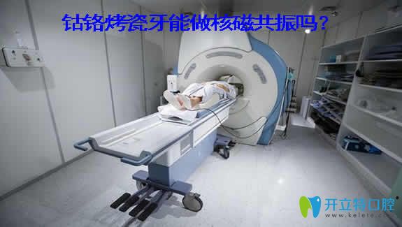 良心牙醫(yī)解析：鈷鉻烤瓷牙能做核磁共振嗎？