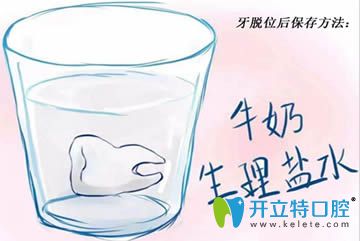 開立特口腔牙外傷脫位保存方法圖