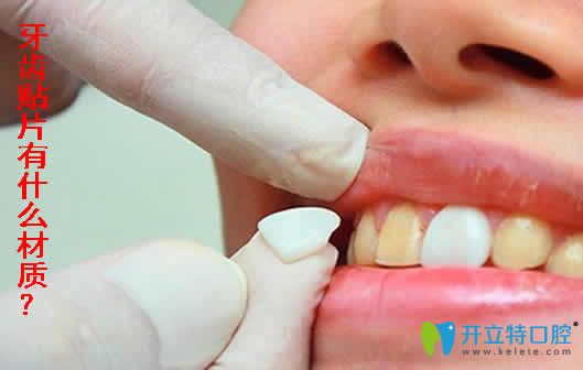 本文介紹牙齒貼片的材質(zhì)和價格及牙齒貼片的優(yōu)缺點