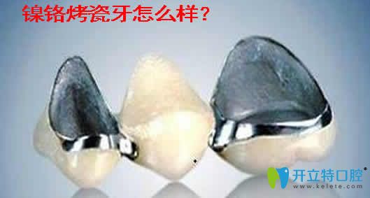 良心牙醫(yī)介紹鎳鉻烤瓷牙好不好及鎳鉻烤瓷牙的副作用