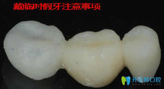 戴臨時(shí)假牙注意事項(xiàng)