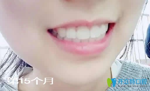 20181206671215.jpg 2.jpg