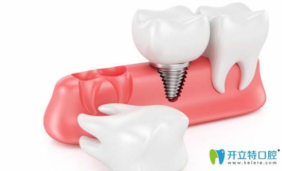 拔智齒后的牙洞很臭很臟的護(hù)理辦法