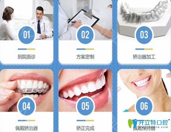<!--<i data=20240703-sp></i>-->牙齒矯正流程 <!--<i data=20240703-sp></i>-->牙齒矯正流程