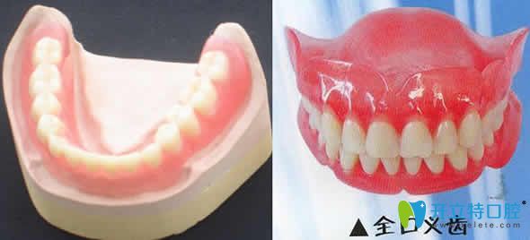 為什么很多活動(dòng)假牙會(huì)失敗 一口好的活動(dòng)假牙價(jià)格是多少錢(qián)