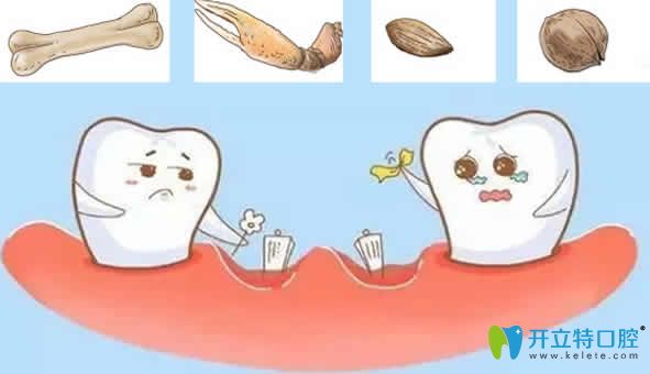 做了種植牙后能咬多硬的東西？有關(guān)種植牙的誤區(qū)看這里