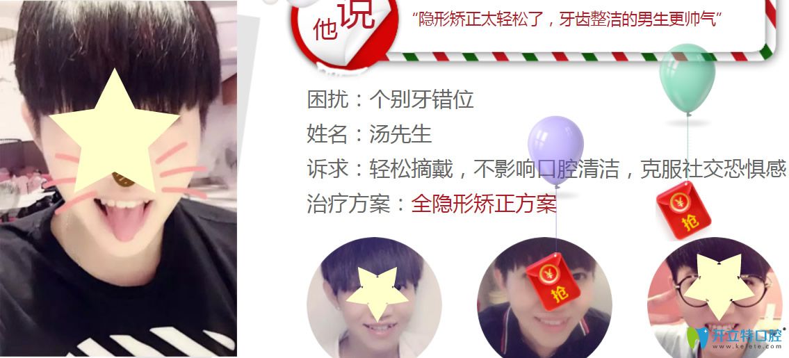 深圳格倫菲爾口腔水平怎么樣？看牙齒正畸真人案例反饋