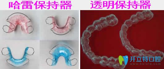 哈雷保持器和透明保持器哪種好？看兩種保持器的優(yōu)勢區(qū)別