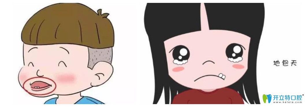 寶寶地包天會(huì)自然好嗎，如果矯正該怎么進(jìn)行，效果好不好