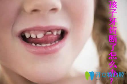 小孩牙齒斷了怎么辦