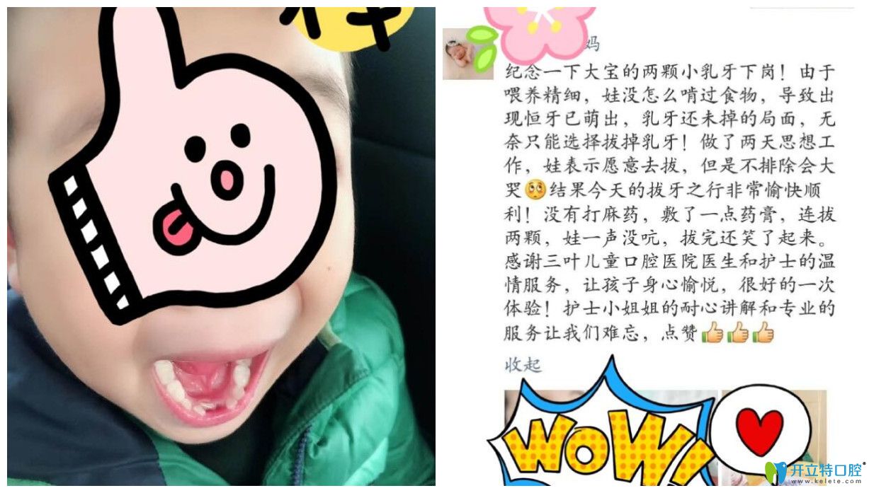 孩子在三葉進行治療后家長點評