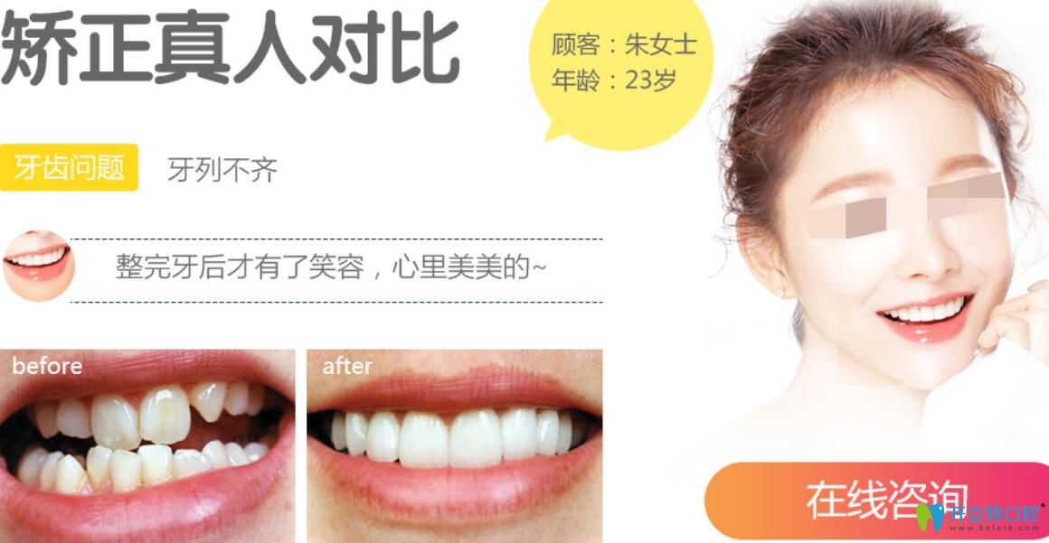 聊城口腔醫(yī)院怎么樣呢？真人牙齒矯正案例效果給你帶來(lái)驚喜