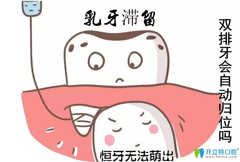 兒童出現(xiàn)了雙排牙怎么辦，會(huì)不會(huì)自從歸位