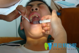 治牙打麻藥注意事項