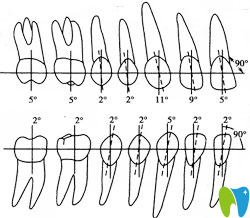 牙齒近、遠(yuǎn)中傾斜范圍