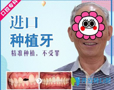 牙大夫與美奧口腔哪個好？美奧口腔種植牙案例來揭曉