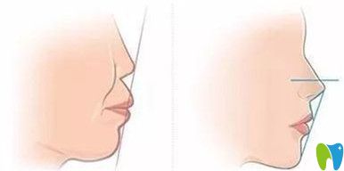 標(biāo)準(zhǔn)和不正常咬合對(duì)照?qǐng)D