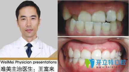 <!--<i data=20240703-sp></i>-->正畸醫(yī)生王富來和案例效果對比圖