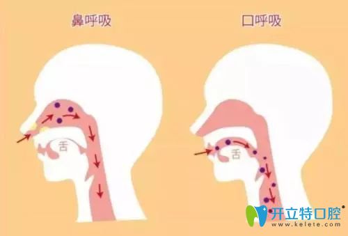 鼻呼吸和口呼吸的區(qū)別