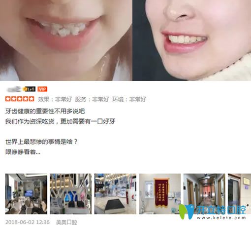 聽在天津做過種植牙和牙齒矯正的牙友說美奧口腔收費不高