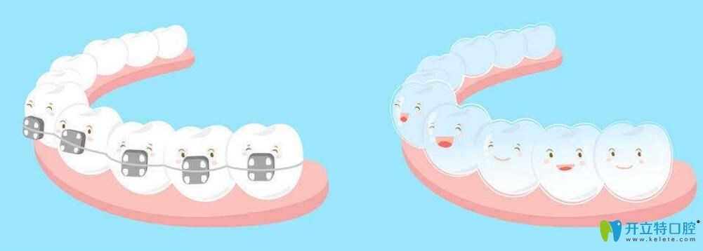 什么是牙齒正畸