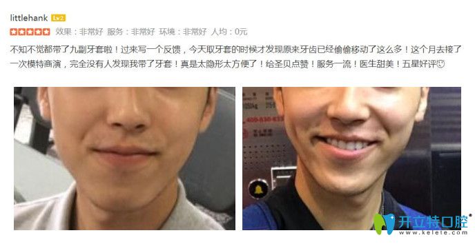 顧客在圣貝口腔做了矯正后來評價