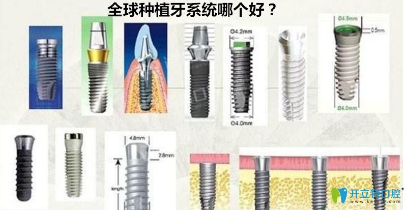 種植牙系統(tǒng)哪個(gè)好？來(lái)看世界種植體排名詳情及價(jià)格表