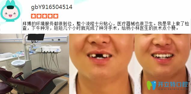 門(mén)牙缺失在拜博做完種植牙對(duì)比圖 門(mén)牙缺失在拜博做完種植牙對(duì)比圖