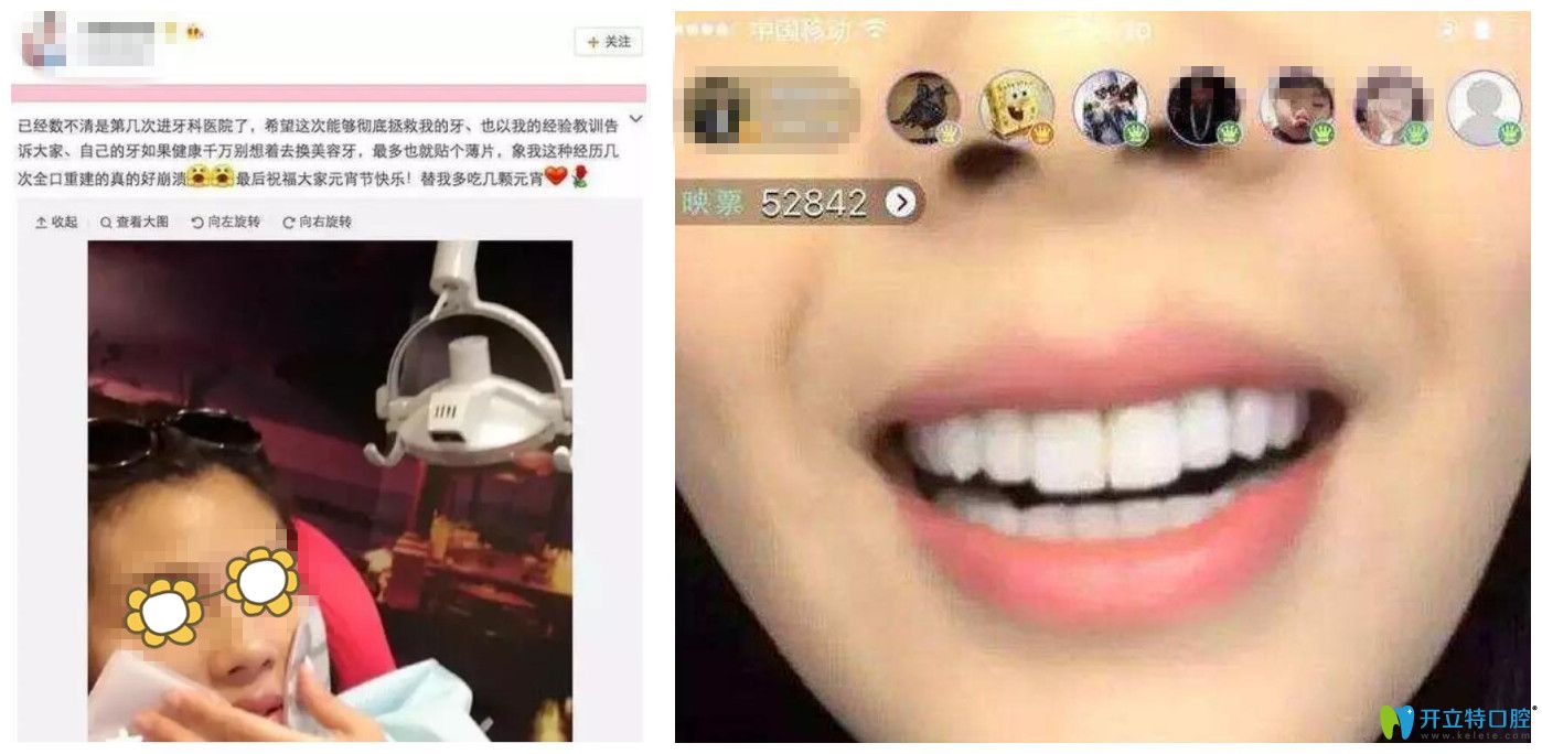 為什么做了烤瓷牙之后有人后悔呢