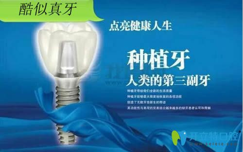 整理的韓國種植牙品牌排行榜中內(nèi)附奧齒泰/登騰等植體價(jià)格