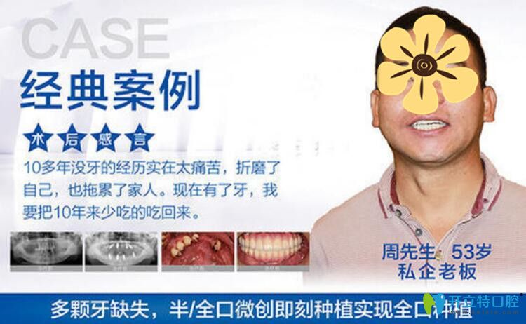 天津美奧口腔7周年，齒刻歡顏，禮享不停