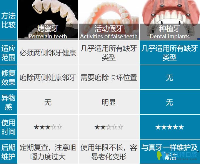 關(guān)于種植牙和活動(dòng)假牙及烤瓷牙的比較