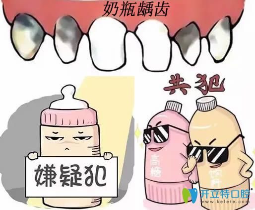 好擔(dān)心奶瓶齲會影響換牙 那寶寶奶瓶齲齒該怎么治療呢？