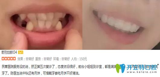 <!--<i data=20240703-sp></i>-->科美口腔陳作鋼醫(yī)生牙齒矯正案例