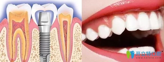 保定合眾口腔牙齒修復(fù)+牙齒美白技術(shù)優(yōu)勢 保定合眾口腔牙齒修復(fù)+牙齒美白技術(shù)優(yōu)勢