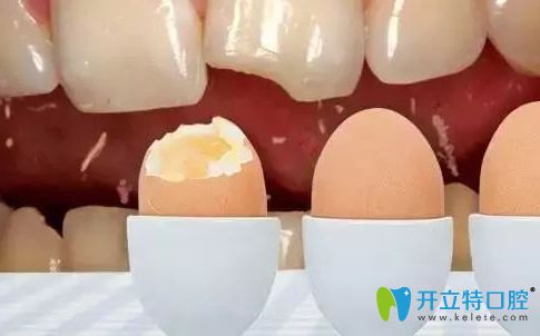 洗牙把牙釉質(zhì)破壞了，聽說牙釉質(zhì)有再生功能這是真的嗎？