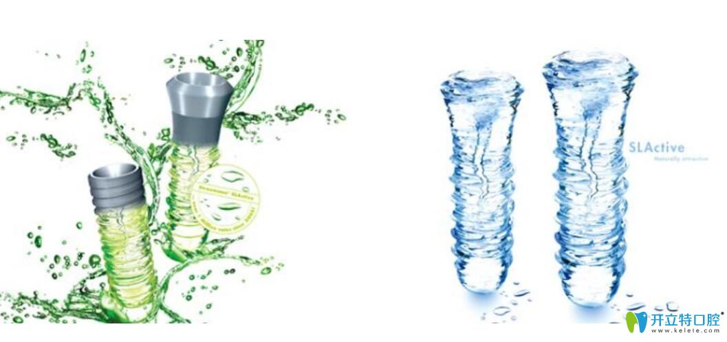 揭秘瑞士iti親水種植體和非親水種植體區(qū)別及價(jià)格是多少