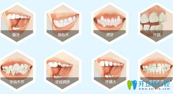 不同的牙齒癥狀矯治時間和方法也不同