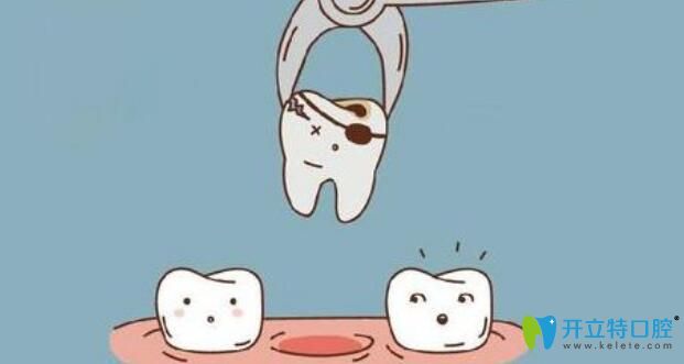 整顆牙齒已經(jīng)裂開到壞死的程度時(shí)