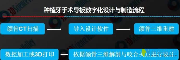 3D導(dǎo)航種植牙制作流程