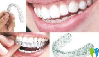 寧波牙博士口腔隱形牙套