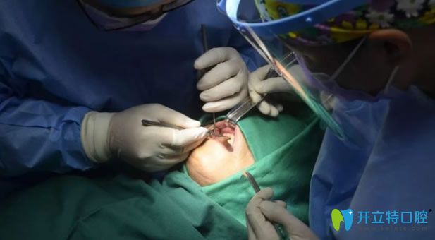 寧波牙博士口腔王道軍醫(yī)生給老爸做種植牙手術(shù)中