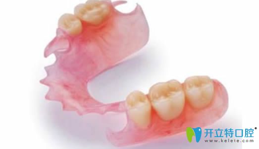 西安諾貝爾郭建強(qiáng)醫(yī)生解答活動(dòng)義齒的種類(lèi)有哪些