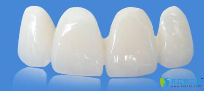 鑄瓷牙是全瓷牙嗎？鑄瓷牙和全瓷牙到底有什么區(qū)別？