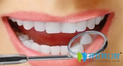 分享激光美白牙齒和冷光美白牙齒的區(qū)別