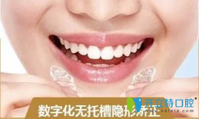 無托槽隱形牙套圖片