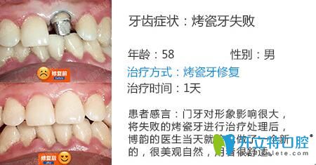 醫(yī)生姓名：周光正   醫(yī)生資質(zhì)：全科醫(yī)生  所屬機(jī)構(gòu)：南京博韻口腔  社會任職：  畢業(yè)院校：畢業(yè)于邢臺<!--<i data=20240703-sp></i>-->口腔醫(yī)學(xué)系  主診項(xiàng)目：牙列缺損修復(fù)、口腔種植、前牙美學(xué)修復(fù)、嵌體修復(fù)及復(fù)雜牙拔除。