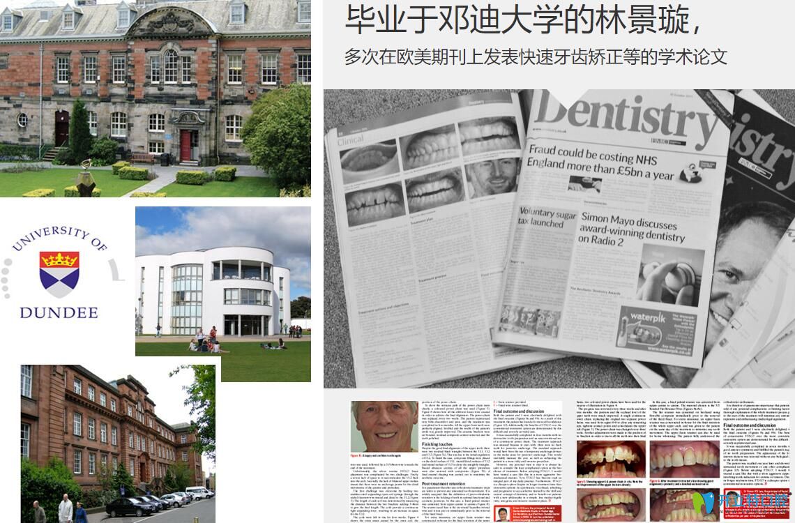 林景璇多次在歐美期刊上發(fā)表快速牙齒矯正等的學(xué)術(shù)論文
