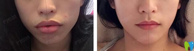 成都極光口腔怎么樣？真人案例再次證明